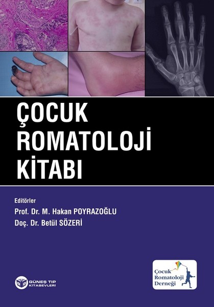 Çocuk Romatoloji Kitabı kitabı