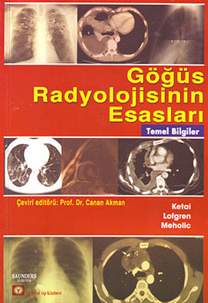 Göğüs Radyolojisinin Esasları kitabı